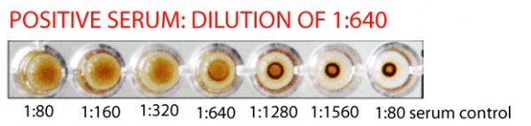 eli_ha_aspergillus[1]