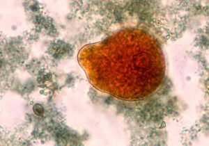 Entamoeba histolytica stained with Kop-Color solution