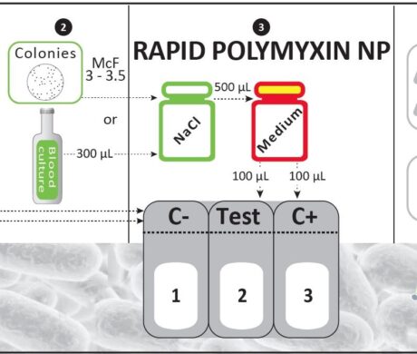 Rapid Polymyxin™ NP Enterobacteriaceae resistance detection