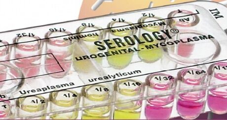 Serology MUG urogenital mycoplasma susceptibility