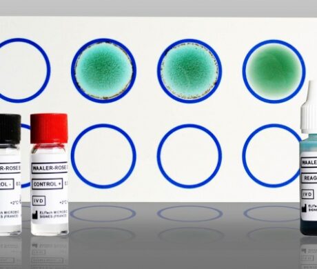 WAALER-ROSE Bicolor rheumatoid factor detection