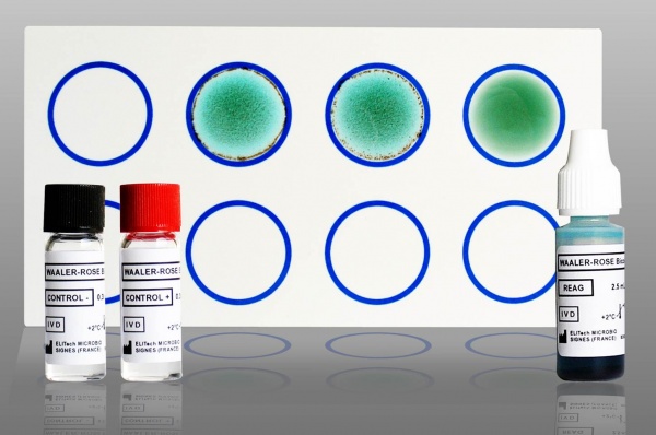 WAALER-ROSE Bicolor rheumatoid factor detection