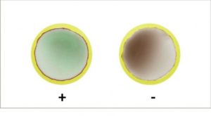 ELITex Bicolor amoeba detection