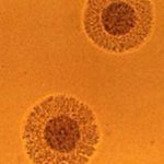 Urogenital mycoplasma detection