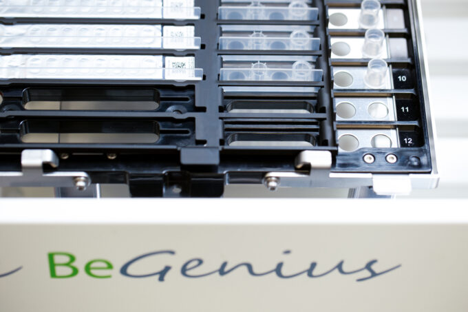 ELITe BeGenius real-time PCR, automated extraction amplification results